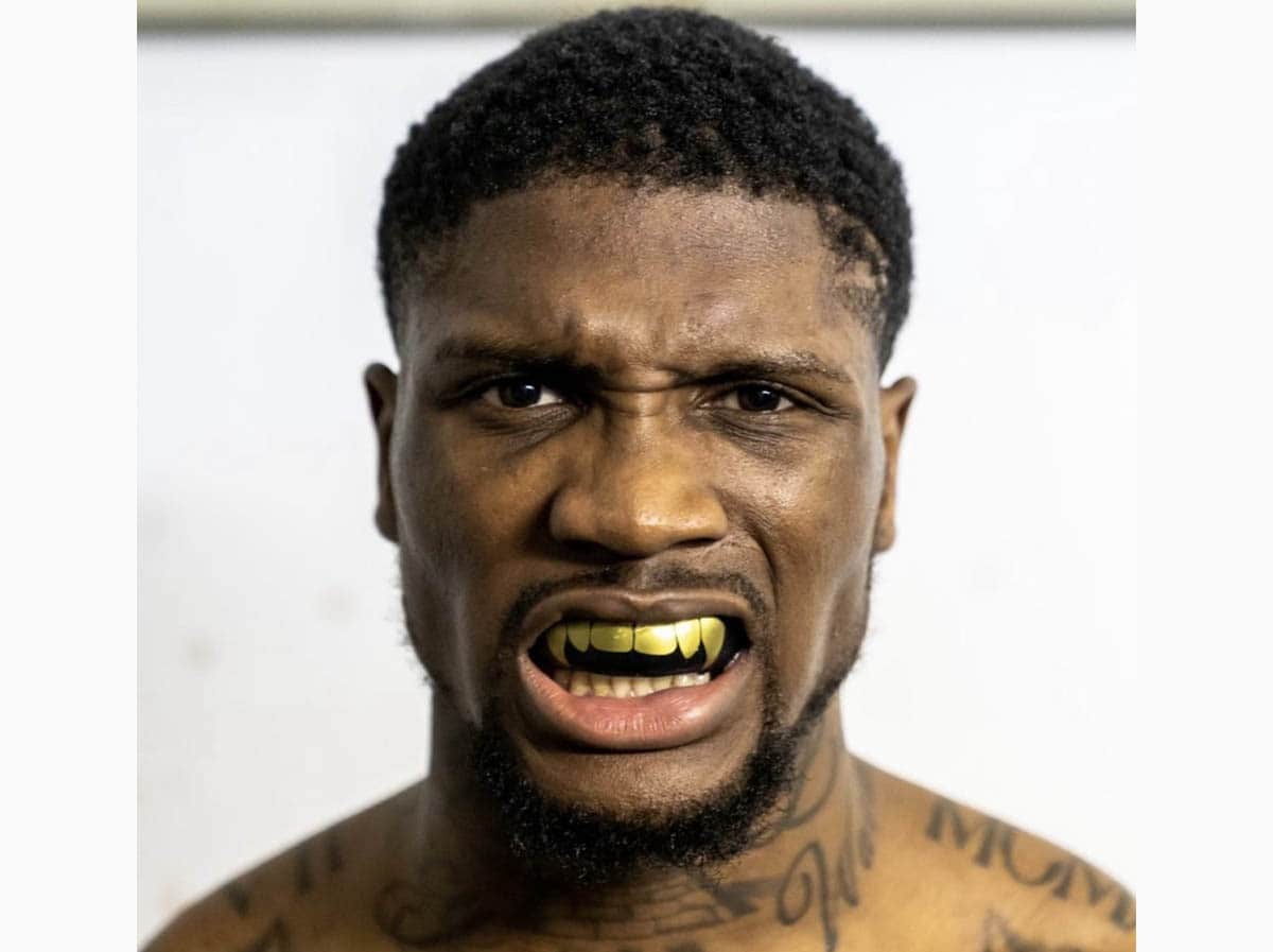 A black sports guy, with curly short hair, wearing artificial golden teeth.