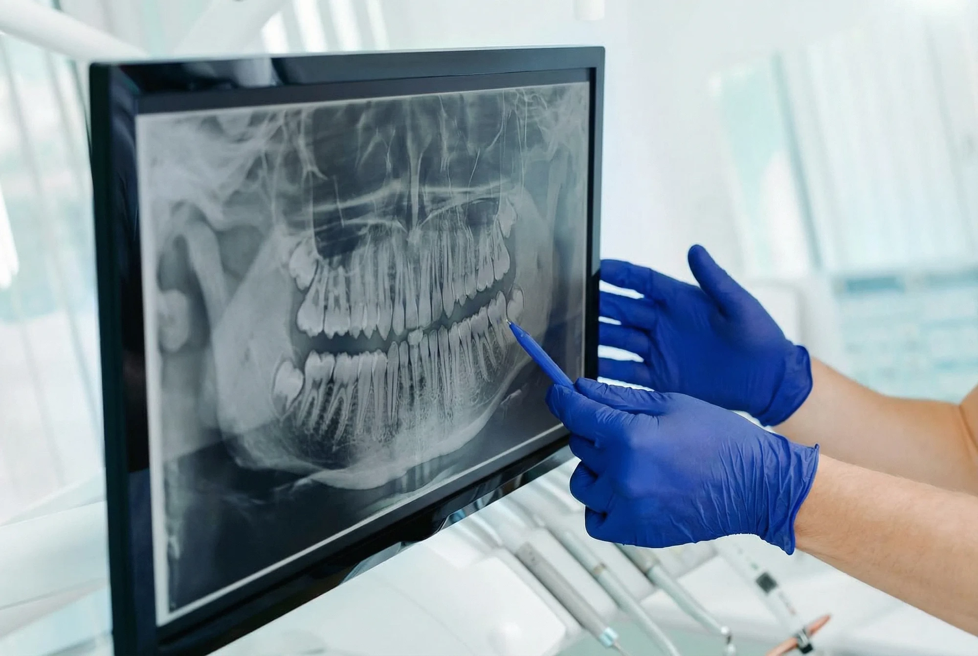 pointing-at-xray